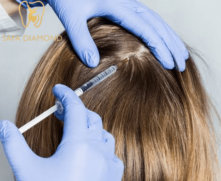افضل عيادة زراعة شعر بالرياض