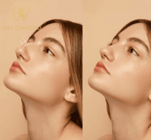 عيادة في جدة للتجميل والجلدية