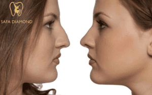 عيادات تجميل الانف في السعودية