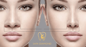 عيادات تجميل الانف في السعودية