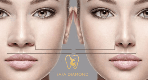 عيادات تجميل الانف في السعودية
