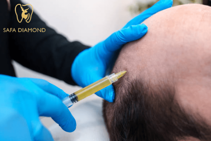 كيف تتم عملية زراعة الشعر وكم تكلفتها في سنة 2025: 0546444116