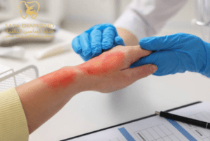 علاج الحساسية الجلدية: 0546444116