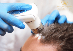 زراعة الشعر للرجال: الخطوات والنتائج والتكلفة 2025: 0546444116