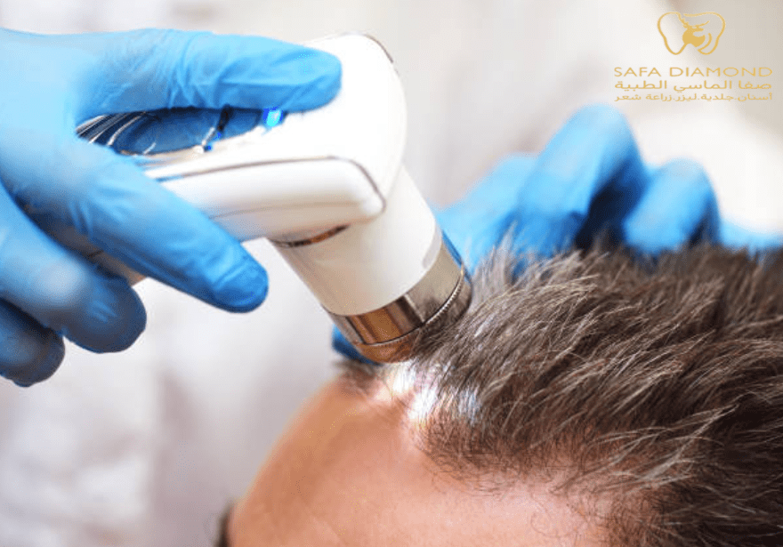زراعة الشعر للرجال: الخطوات والنتائج والتكلفة 2025: 0546444116