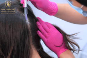 كم تستغرق عملية زراعة الشعر: 0546444116