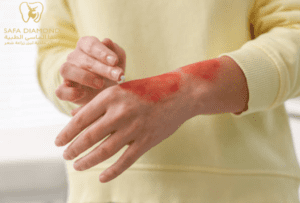افضل عيادة في جدة لعلاج الأمراض الجلدية بالصور: 0546444116