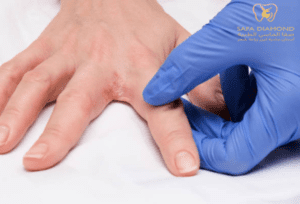افضل عيادة في جدة لعلاج الأمراض الجلدية بالصور: 0546444116