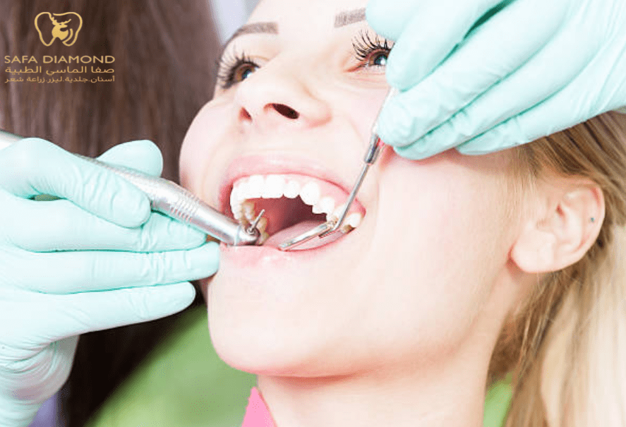 افضل عيادة لعلاج التسوس: 0546444116