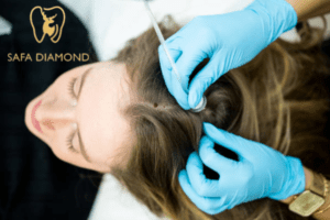 أفضل مركز علاج تساقط شعر في السعودية: 0546444116