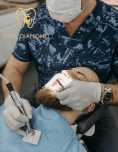 كم يكلف حشو الأسنان: 0546444116
