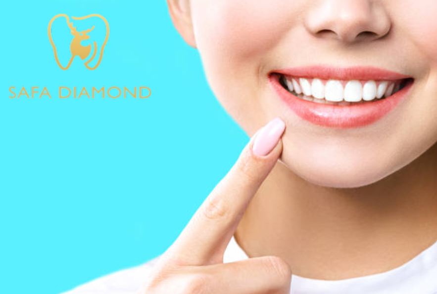 عيادة متخصصة في زراعة وتجميل الأسنان: 0546444116