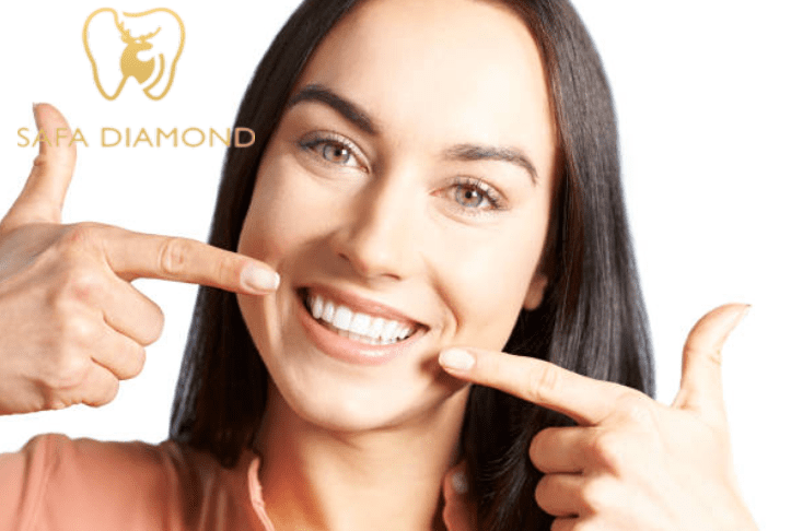 كيف احصل على ابتسامة هوليود: 0546444116