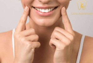كيف احصل على ابتسامة هوليود: 0546444116