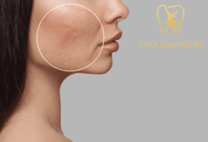 افضل دكتور جلدية بجدة للتصبغات: 0546444116