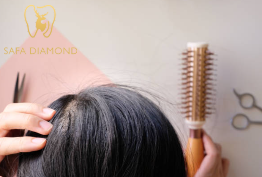 أسباب تساقط الشعر عند الرجال والنساء وطرق العلاج الحديثة: 0546444116
