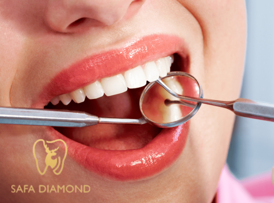 افضل عيادة لحشو العصب في السعودية: 0546444116