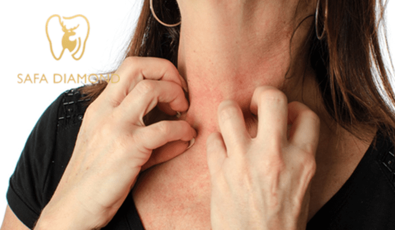 أفضل عيادة لعلاج الحساسية الجلدية: 0546444116