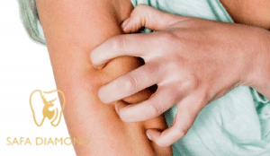 أفضل عيادة لعلاج الحساسية الجلدية: 0546444116