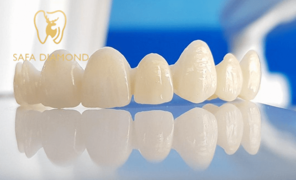 تلبيسة الزيركون للاسنان الأمامية: 0546444116