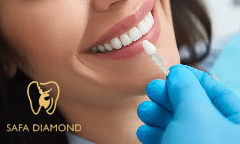 عيادة في جدة تقدم خدمات متكاملة لتجميل وعلاج الأسنان: 0546444116