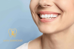 ابتسامة هوليود المتحركة سعرها: 0546444116