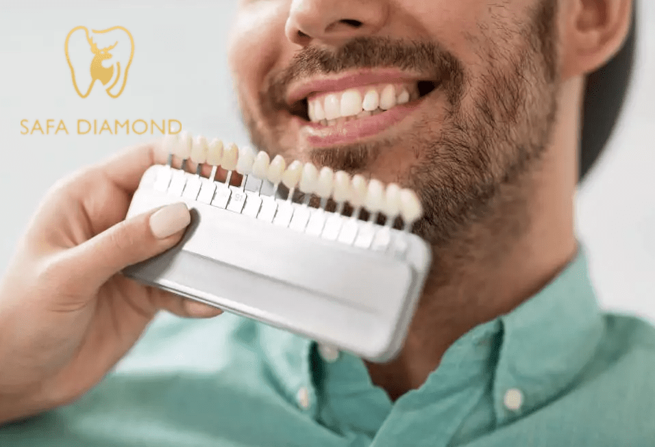 ما هو الزيركون؟ ولماذا يستخدم في تلبيسات الأسنان: 0546444116