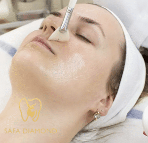 مراحل التقشير الكيميائي للوجة بالصور: 0546444116