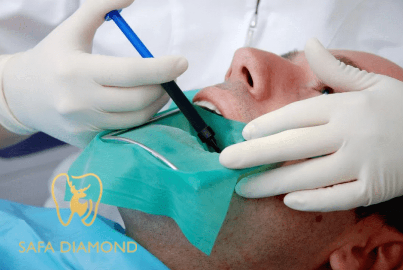 افضل عيادة في السعودية لنزع وعلاج عصب الأسنان: 0546444116