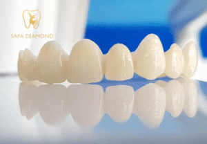 تركيبات الزيركون للسن الواحد: 0546444116