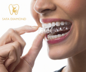 عيادة في جدة تقدم خدمات متكاملة لتجميل وعلاج الأسنان: 0546444116