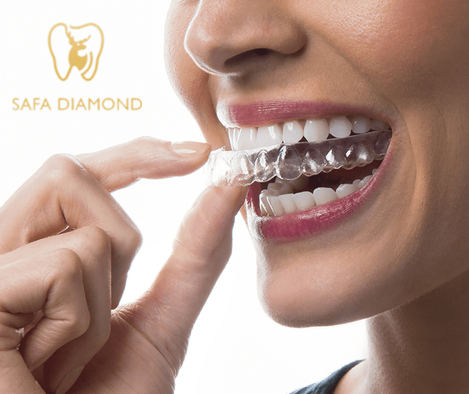 فين أركب تقويم أسنان بجودة عالية في جدة: 0546444116