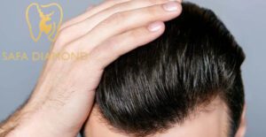 هل زراعة الشعر مكلفة في السعودية: 0546444116