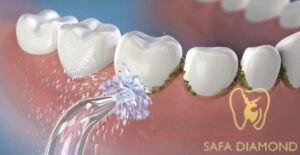 سعر تنظيف الجير في السعودية: 0546444116