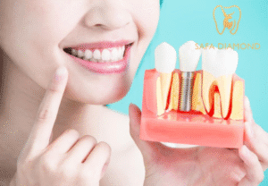 وش أفضل مكان أزرع فيه أسنان في جدة: 0546444116