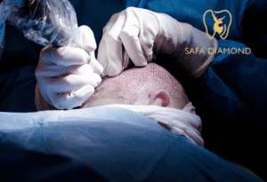 أفضل مركز لزراعة الشعر في السعودية 2025: 0546444116