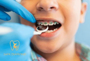 أفضل عيادات التقويم للأطفال في جدة: 0546444116