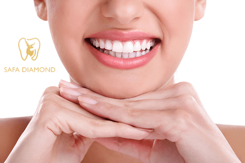 أفضل عيادة لتبييض الأسنان في جدة: 0546444116