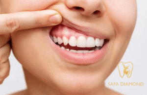 عيادة متخصصة في علاج التهابات اللثة والعصب: 0546444116