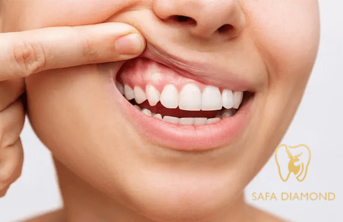 أفضل عيادة أسنان في جدة: 0546444116