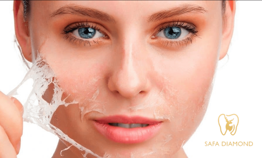 ما هي أفضل عيادة في جدة لجلسات التقشير الكيميائي الآمن: 0546444116