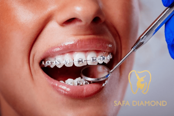 احسن عيادات اسنان بجدة لتجميل وعلاج الأسنان: 0546444116