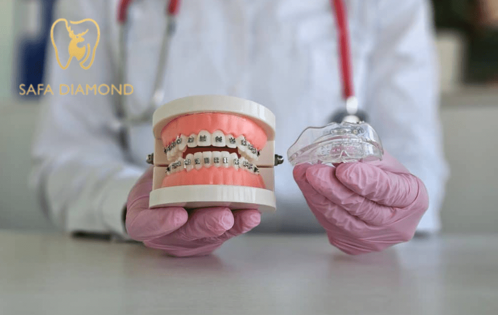 فين أركب تقويم أسنان بجودة عالية في جدة: 0546444116