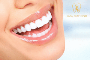 خطوات تركيب ابتسامة هوليود في جدة: 0546444116