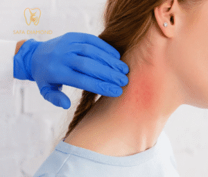 عيادات جلدية بجدة للرجال: 0546444116