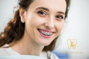 عيادات تقويم اسنان بجدة رخيصة: 0546444116