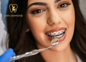 عيادات تقويم اسنان بجدة رخيصة: 0546444116