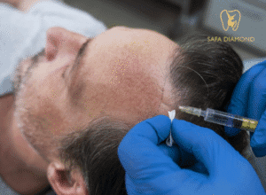 زراعة الشعر في جدة الحمدانية: 0546444116