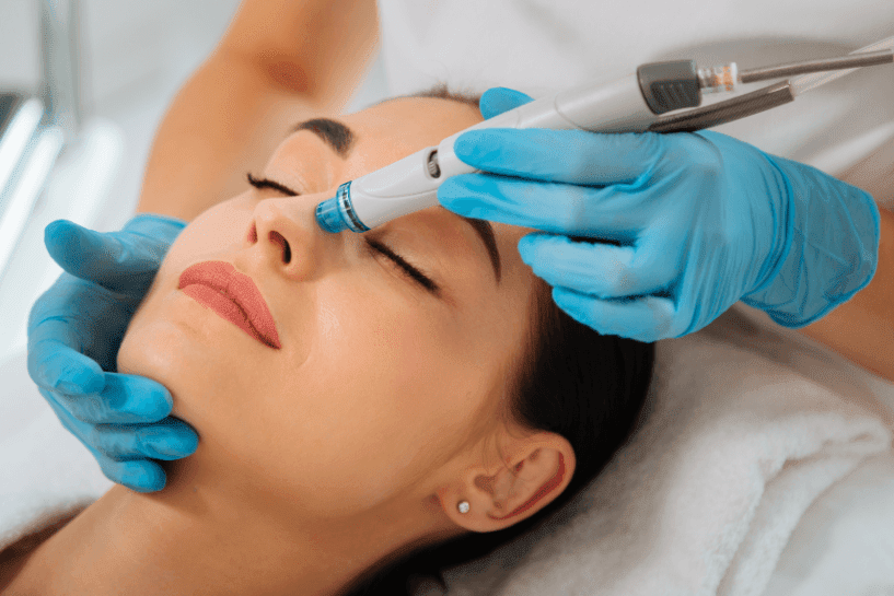 أفضل عيادة تنظيف بشرة في جدة: 0546444116