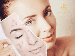 افضل دكتور جلدية في جدة لعلاج حب الشباب: 0546444116
